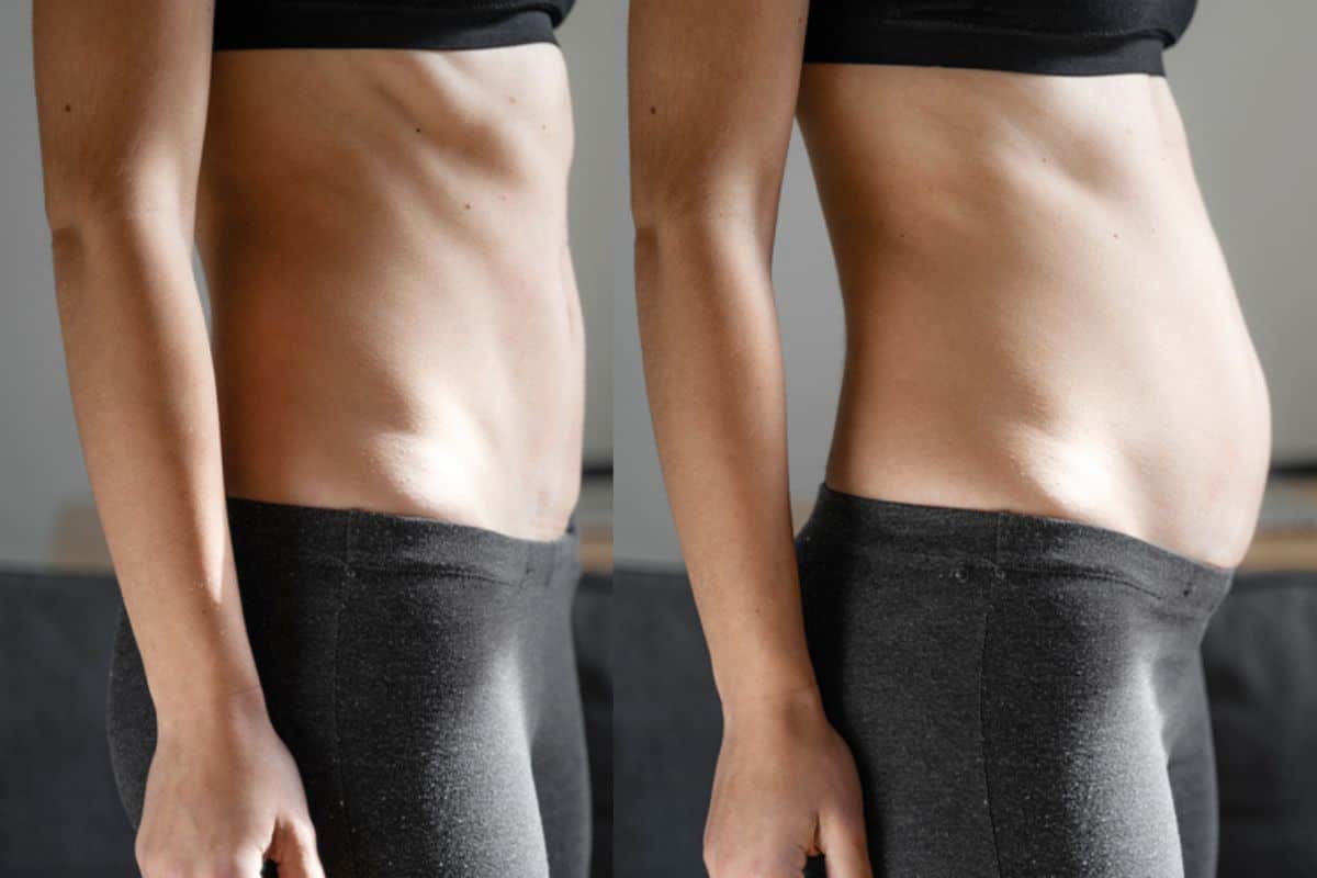 How long does diastasis recti take to improve Spalding?