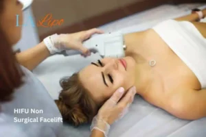 Woman having Hi-Fu to reduce wrinkles Spalding.