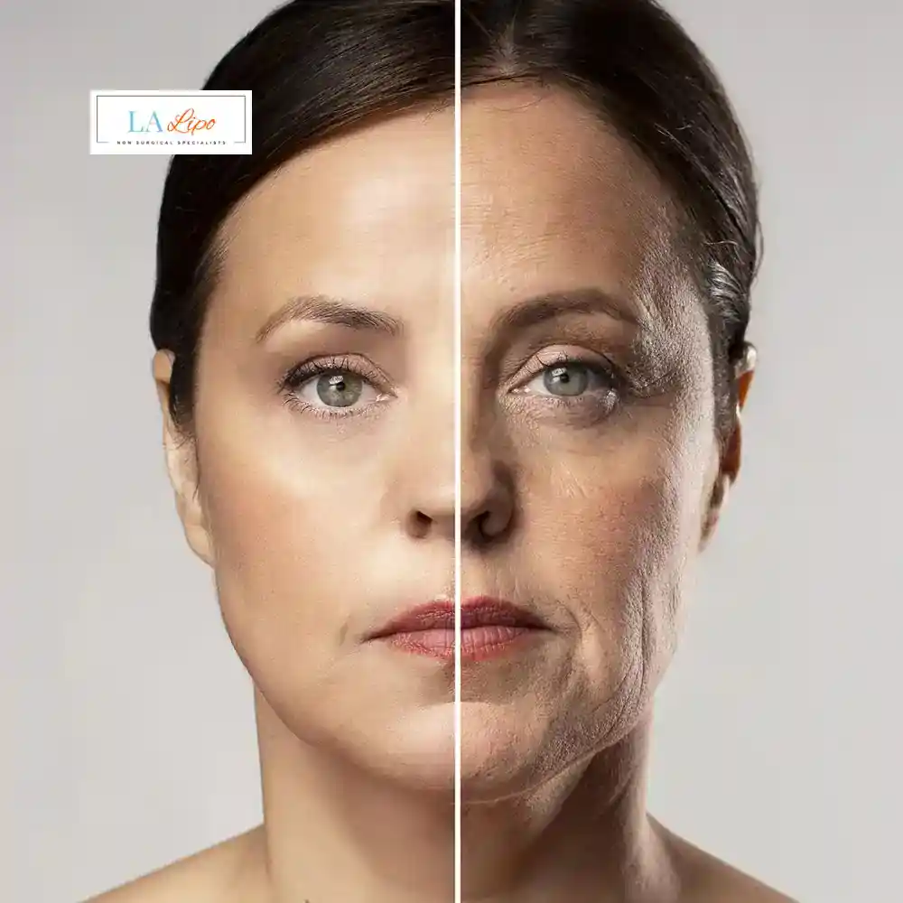 How Can You Tell If Non-Surgical Skin Tightening Is Right for You Spalding?