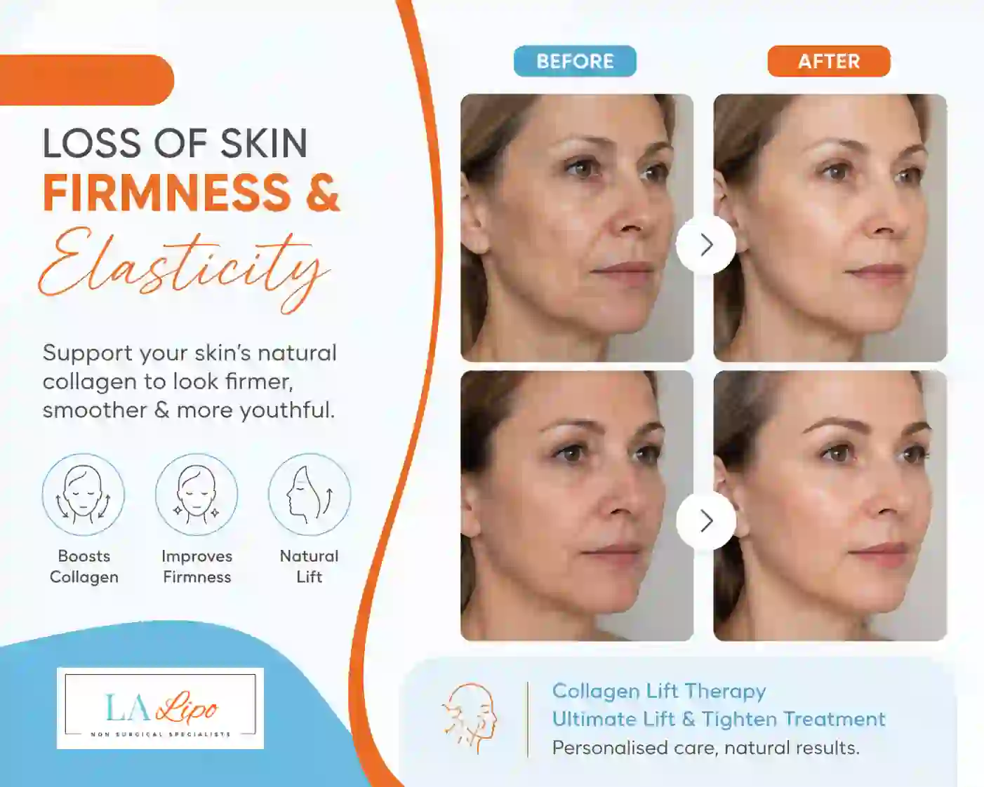 Sign #7: Loss of Skin Firmness and Elasticity Spalding